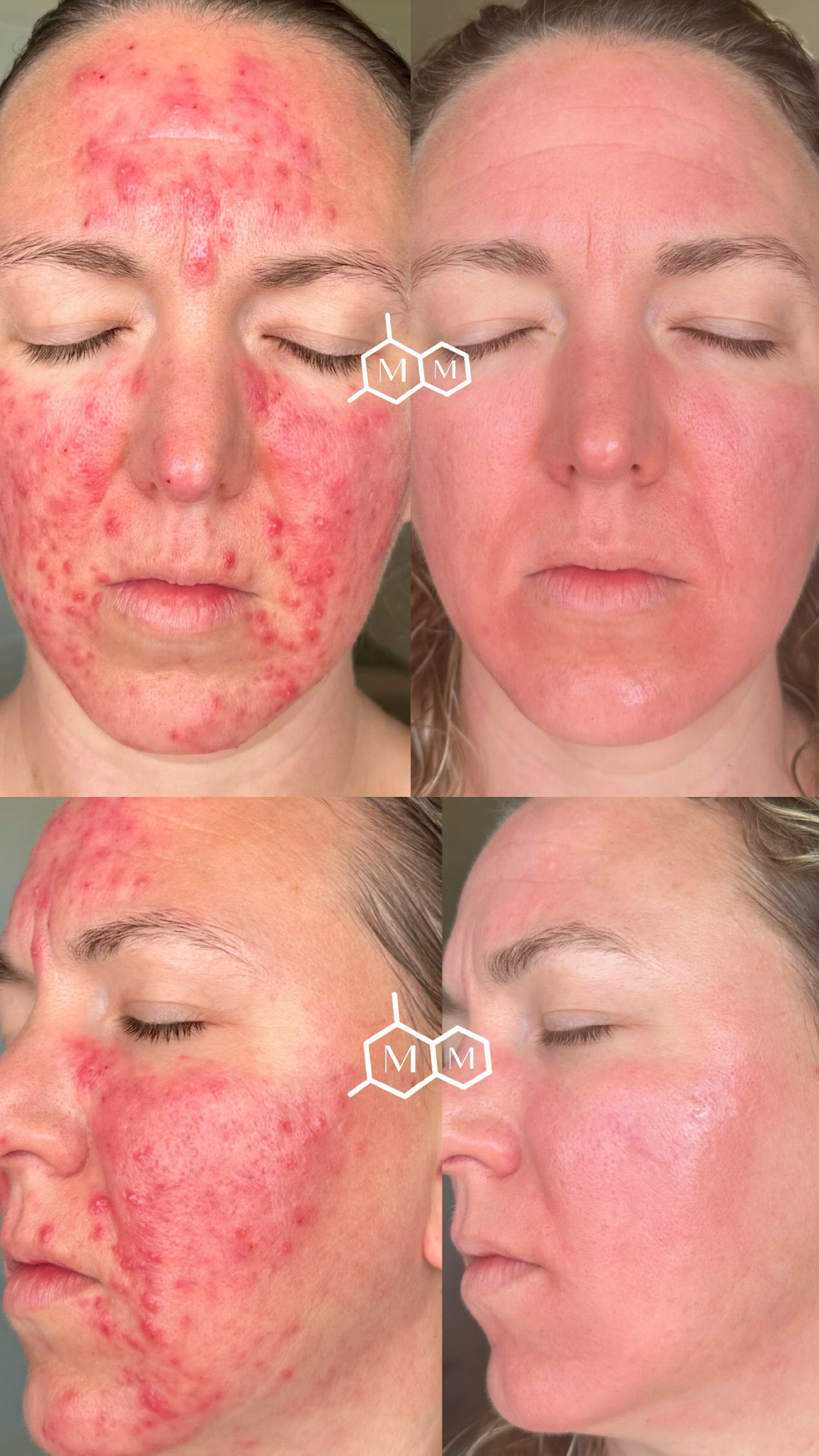 Serum Nº 1 | Malorie Miles Skincare