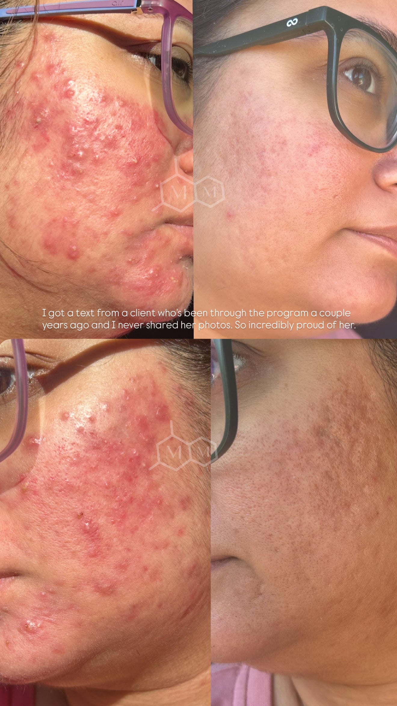 Serum Nº 1 | Malorie Miles Skincare