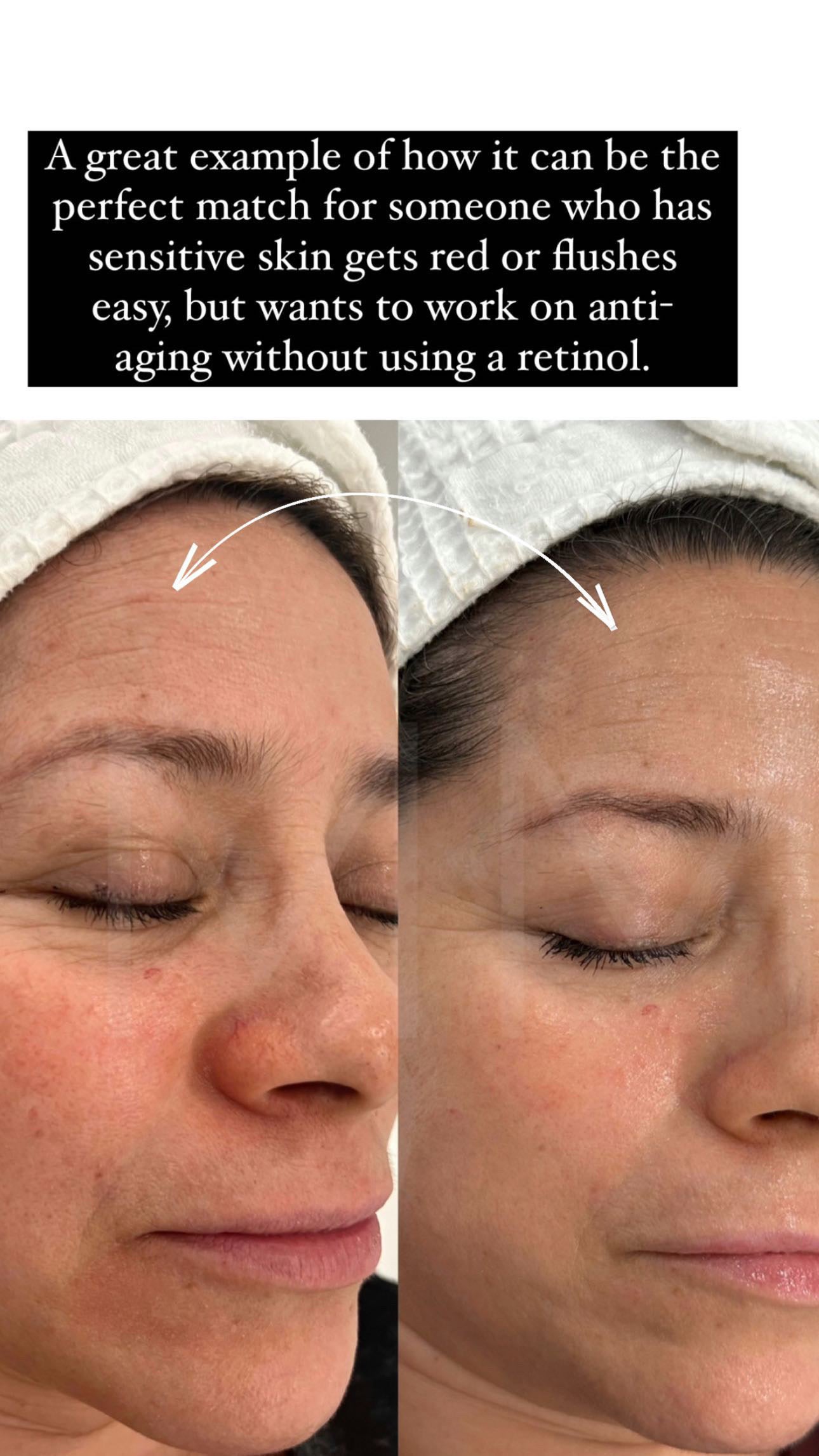 JUMBO PEPTIDE COMPLEX | MM SKINCARE & ACNE CLINIC